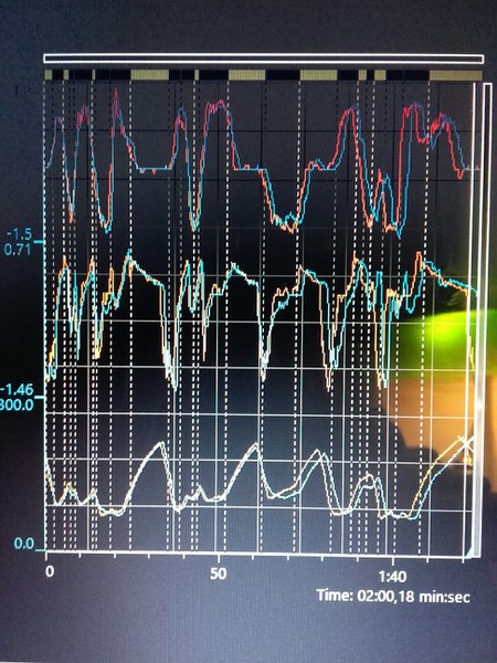 Stage 3 mit und ohne Schild.jpg